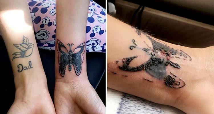 Tattoo Scabs: Prevention Is The Key To Gorgeous Ink